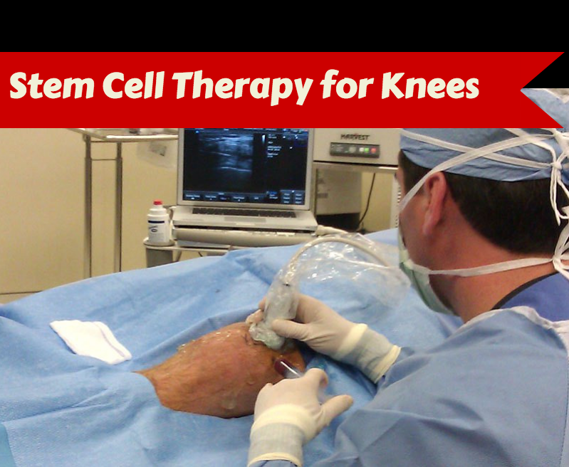 This is STEM CELL THERAPY on knees
